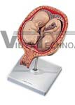 5th Month Twin Fetuses, normal position Pregnancy Model